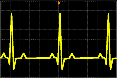 Rigol Oscilloscope Screen Copy